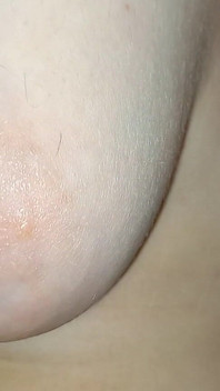 Hairy Breasts