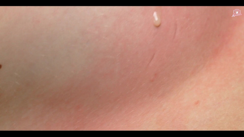 Medi Voi: Chceš ochutnat?