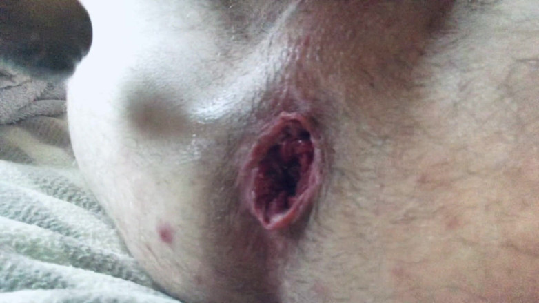 Homemade gay assplay: Dilduje mi zadek