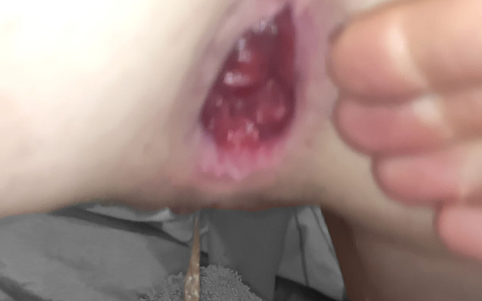 In Need of the Fist: 我让我的 21f 妓女混蛋拳交，而我反复潮吹