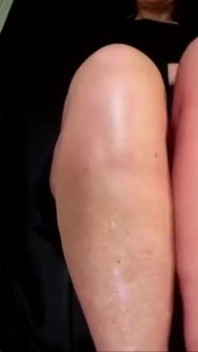 Crossed Leg Vid Ii