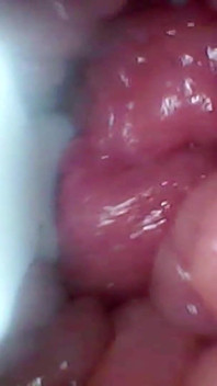 Kamera Endoscope merakam G Spot Isteri Saya. Video Pendidikan Rakaman dekat