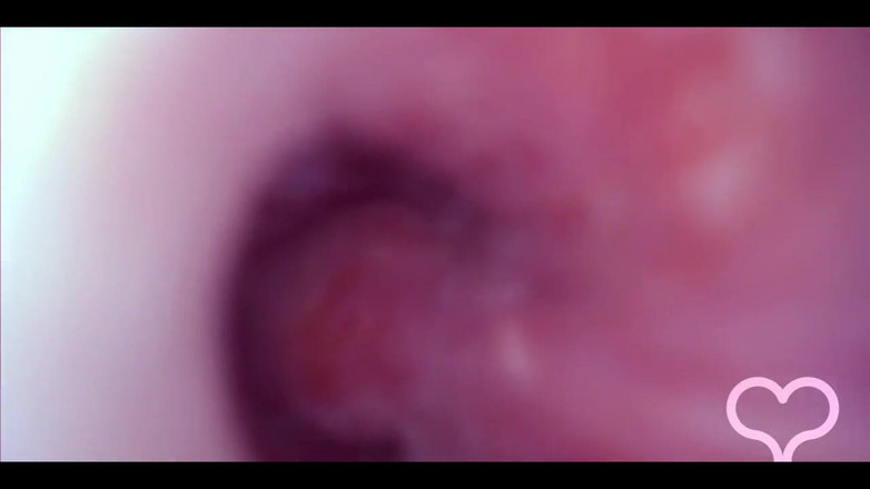 Lina Free: マンコに犯され、膀胱にカメラ、狂った膨らみ!