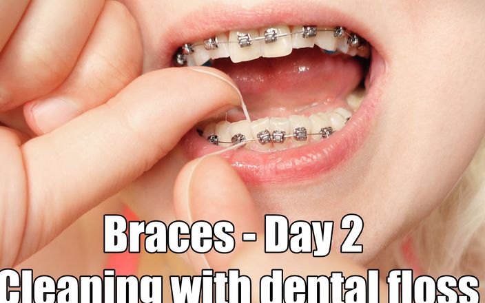 Arya Grander: Yakın çekim ağız turu, diş teli ve diş ipliği
