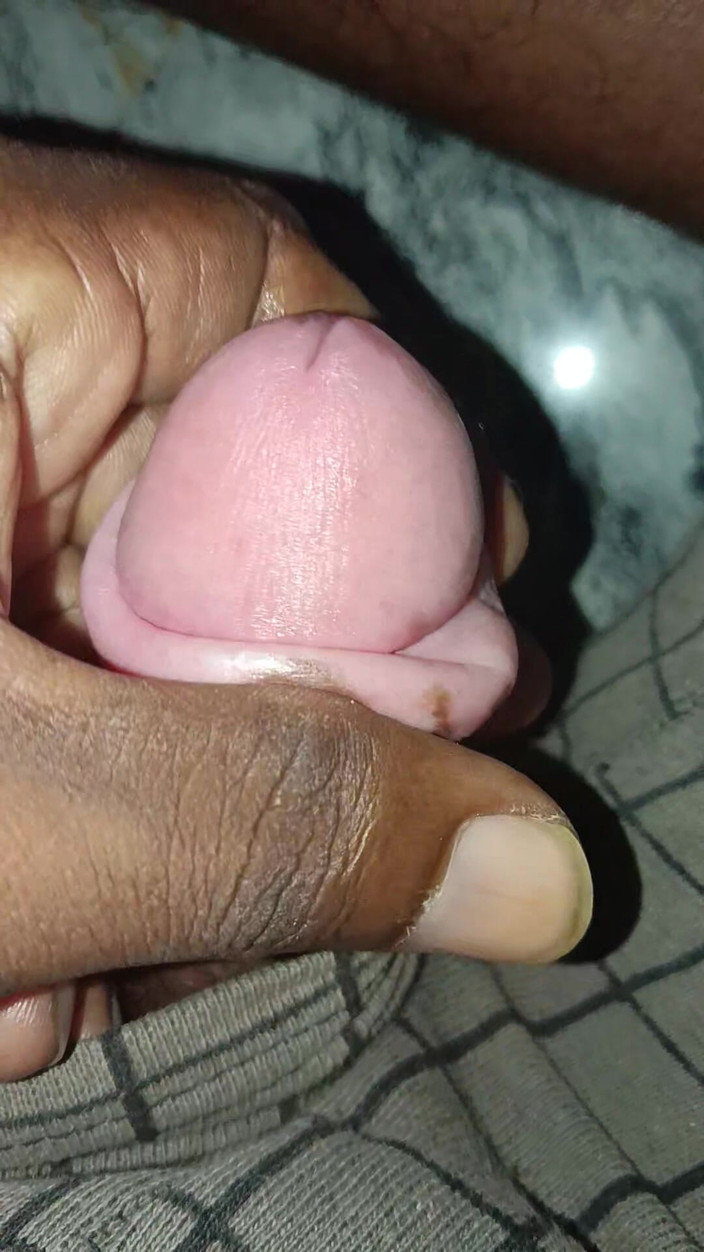 Devson: Hand dela penis