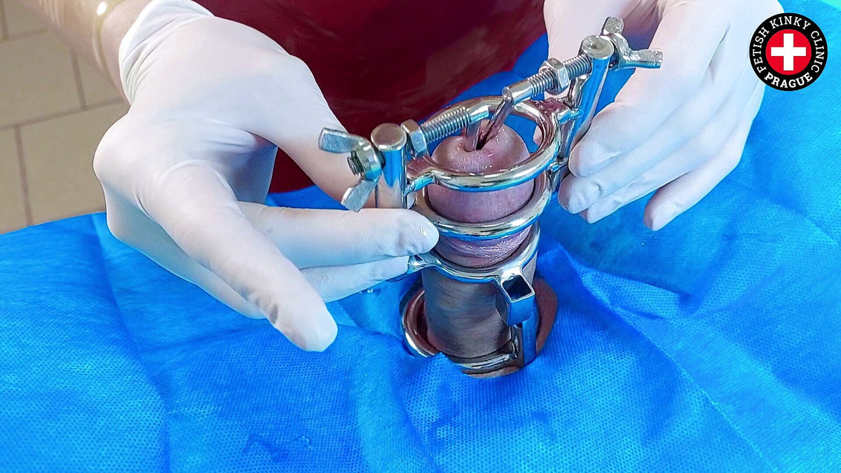 Urethral Stretching