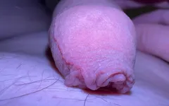 Macro Skin on My Dick