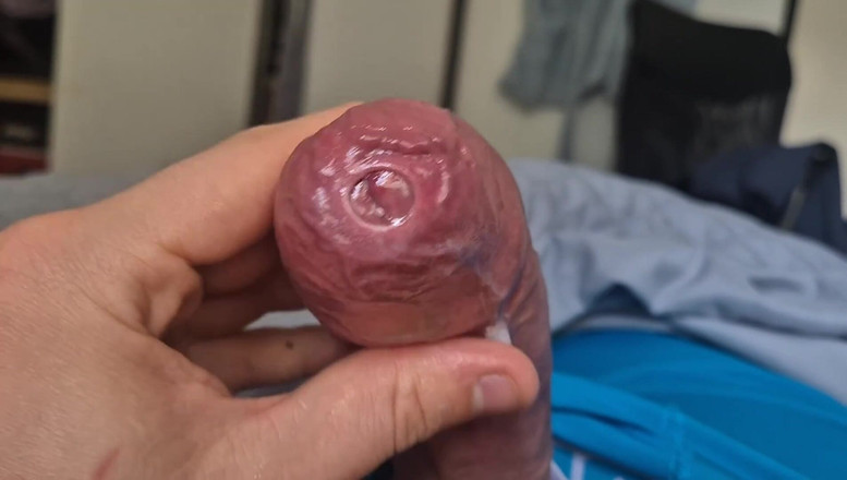GloomyChase977: Phimosis kuk precum droppa närbild