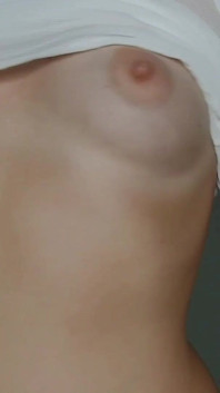 Pad Bulge, Bloated Belly Stretching Exercise Clip on My Profile