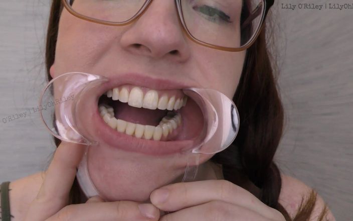 Lily O'Riley: メガネと隙間:11分間の歯科用スペキュラムストレッチドロールセッション