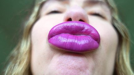 Rarible Diamond: Pucker Lips Custom