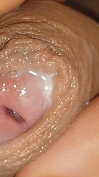 Le Liquide Urétral En Grande Quantité Le Rend Glissant.