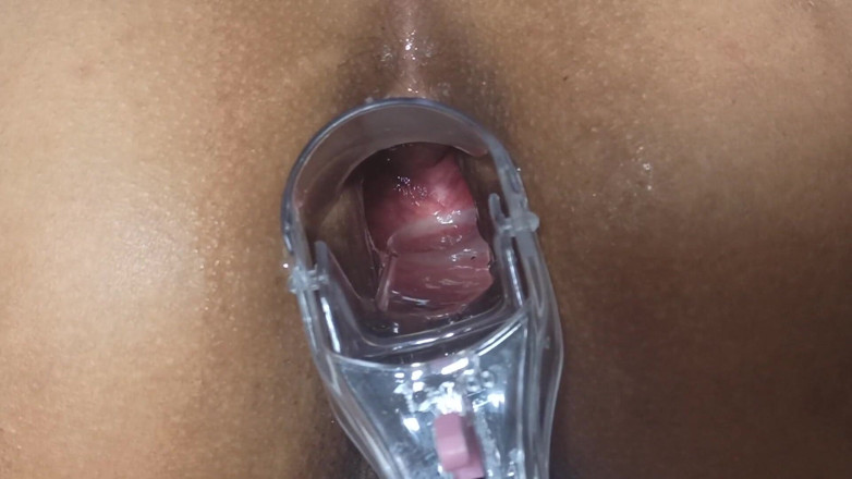 Xamy_97: Speculum in my anus part 1