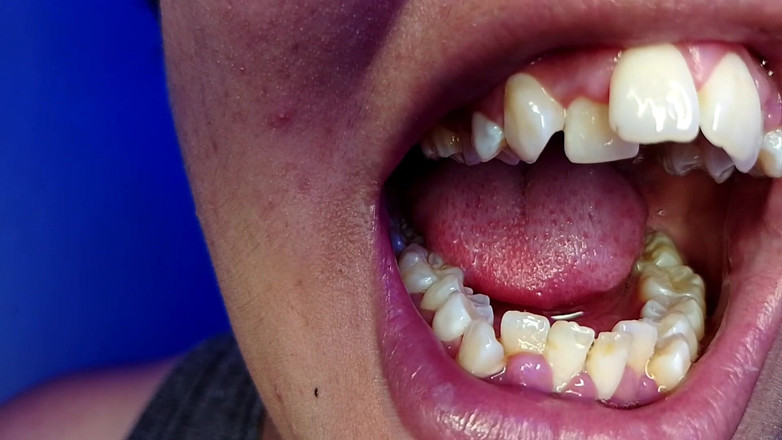 Elimoon: Îmi spăl dinții și îți arăt Dinții mei (prim-plan)