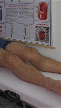 Une Infirmière Observe L’érection Du Patient