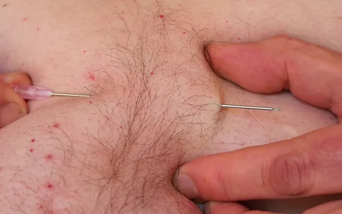 Qualzucht: Just a Few Needles...