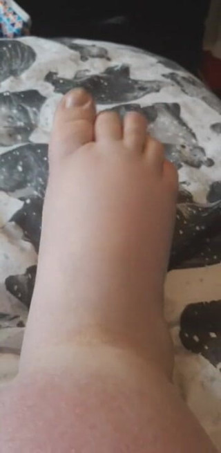 SSBBWLadyBrads: Fat chubby feet