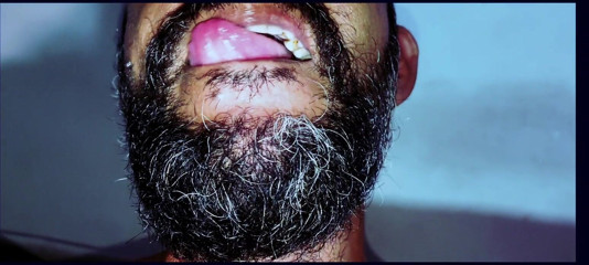 Rock F hairy: Mes fesses