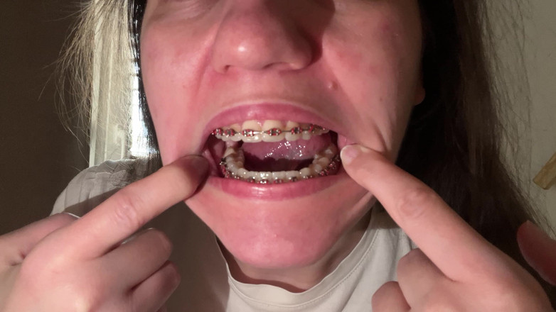 NicoleRay: Menjilati kawat gigi dengan lidah Anda