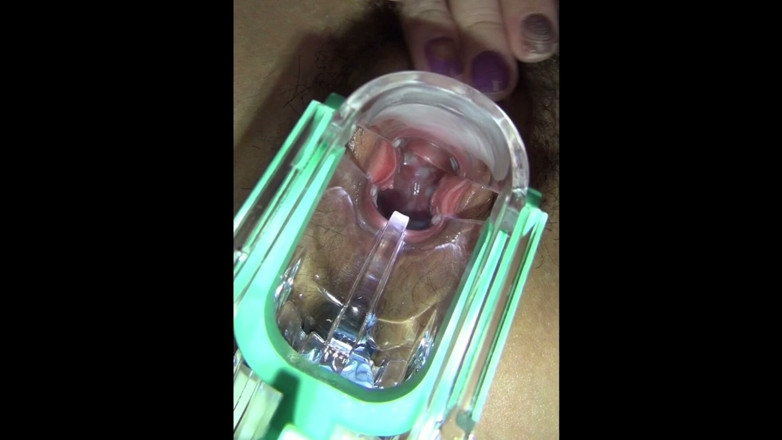 reikodouga: Vaginal Observation Video 1