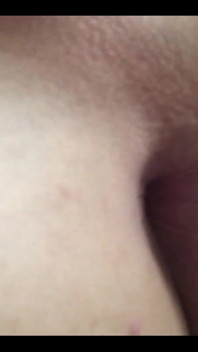 My hole today