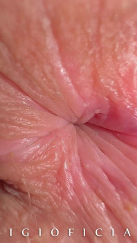 What if We Take High End Close up Camera and Shot 18 Years Old Girl Butthole Close up?