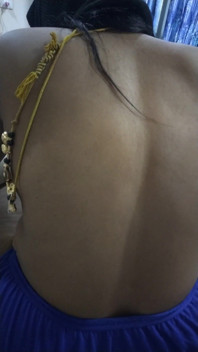 Back Hot