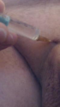 Limping Dick