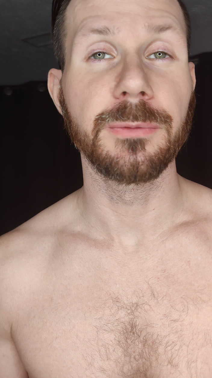 Albino Adonis: Приветствовать