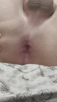 My Ass