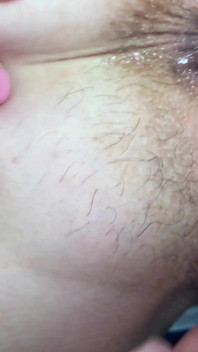 Tổng hợp cận cảnh hậu môn sưng đau nhói và đi tiểu. Nó có bật lên không?