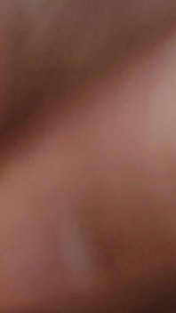 클로즈업에서 큰 포피와 고환이 나왔어요.