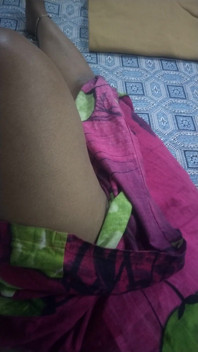 Hot Leg