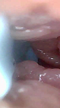 Guía Visual De Estimulación Del Punto G Y Perspectiva Del Endoscopio Del Orgasmo