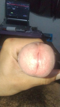 Smegma Big Uncut Smell