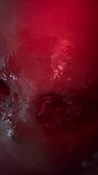 Whore’s Blown Out Cunt and Asshole