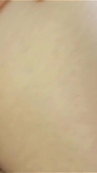 Culo peloso dito