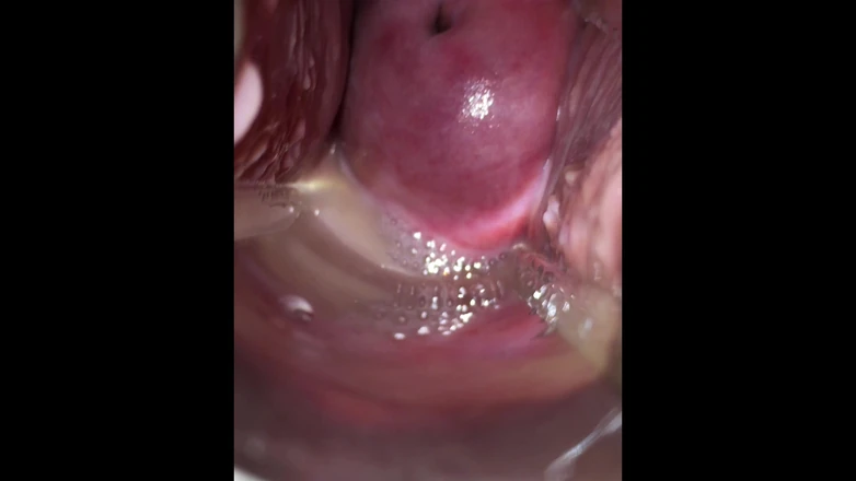 VeeVee Vixen: Cum Cervix Insemination