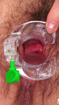 Cervical Screening of Hairy Granny Lola Wild