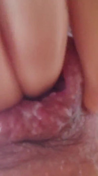 Lỗ đồng tính lớn