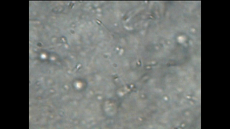 Mark Hannes: 顕微鏡下でのフレッシュライトファックオナニーと精子