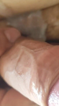 Uncircumcised Phimosis Has the First Ejaculation.