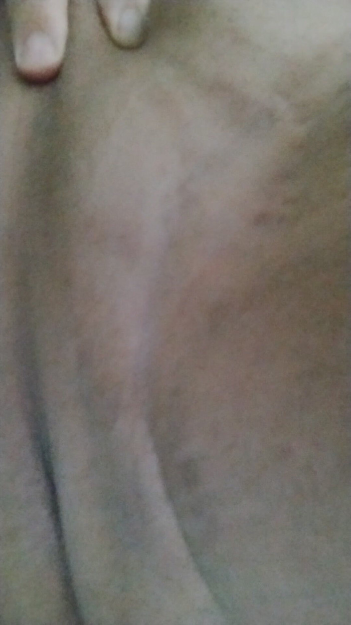 JG Risk: 3-8-2026 Шоу Taint