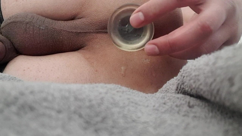 BiCgn: Niềm vui hậu môn