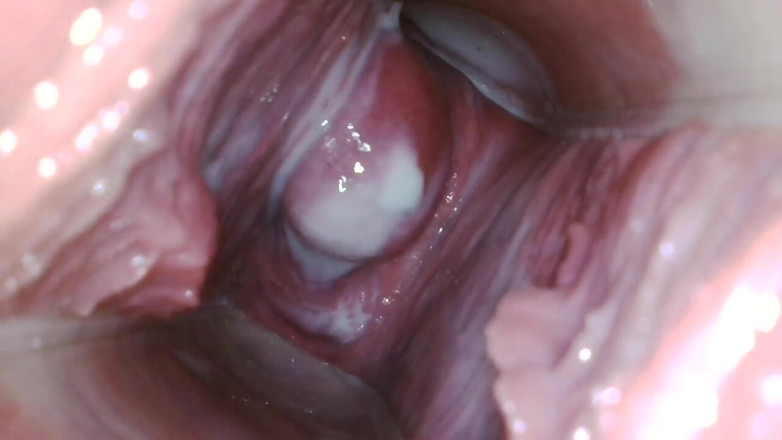 JANA studios: Endoscope in my pussy