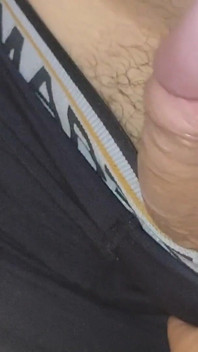 Amazing Upright Rough Venous Frenulum.