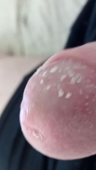 Smegma Foreskin Roll #2