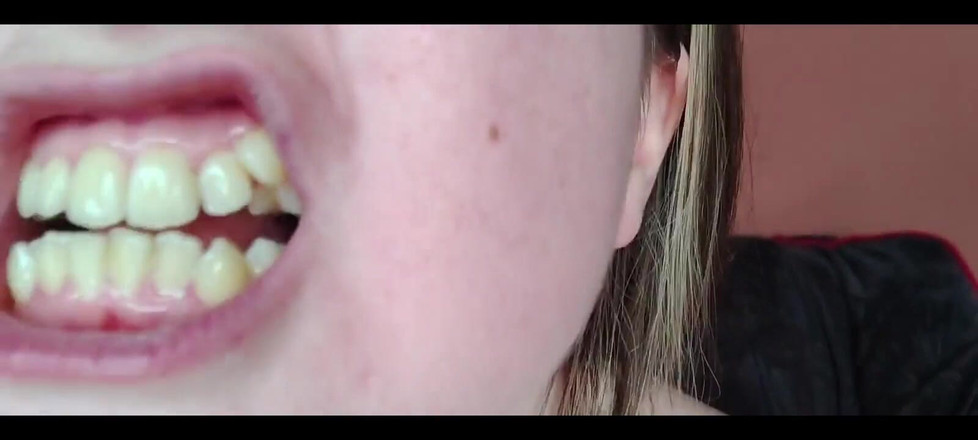 RavenHearth666VIP: मेरा मुंह, दांत, जीभ और गला ऊपर क्लोज