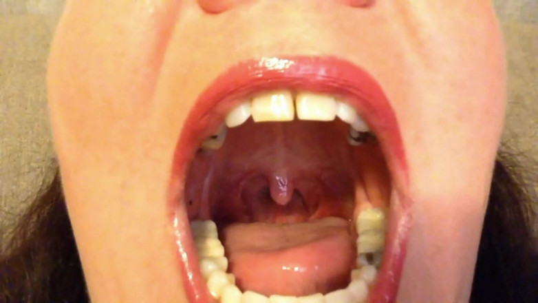 Lily Lipstixxx: Mouth inspection - Be careful, I bite!