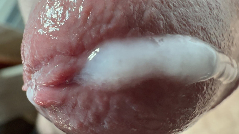 Leonardo-1974: Nahaufnahme von Sperma